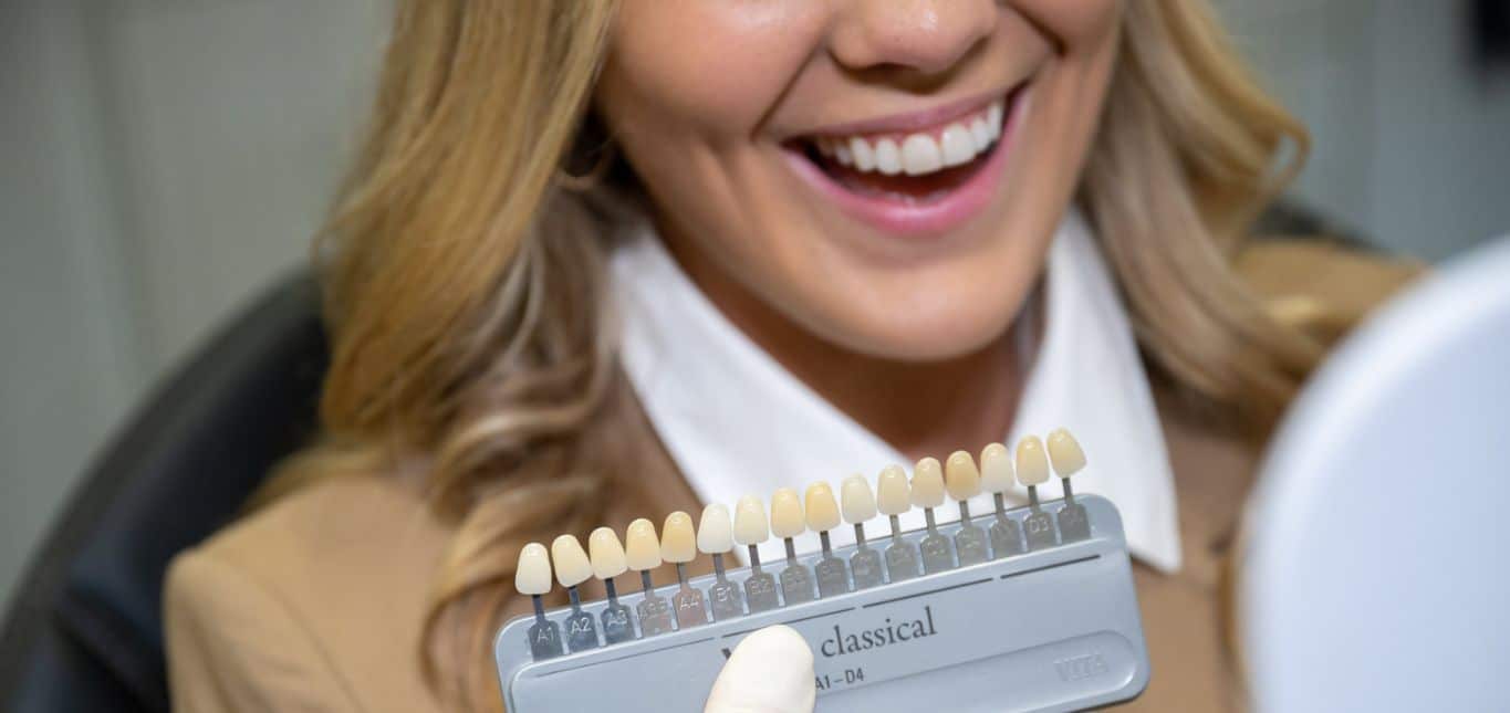 Composite Bonding Fitzrovia