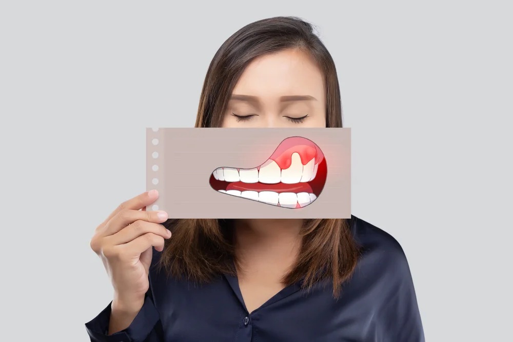 The Silent threat to Your Smile: Understanding Gum Disease