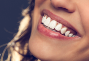 Custom dentures in Fitzrovia for a natural and confident smile